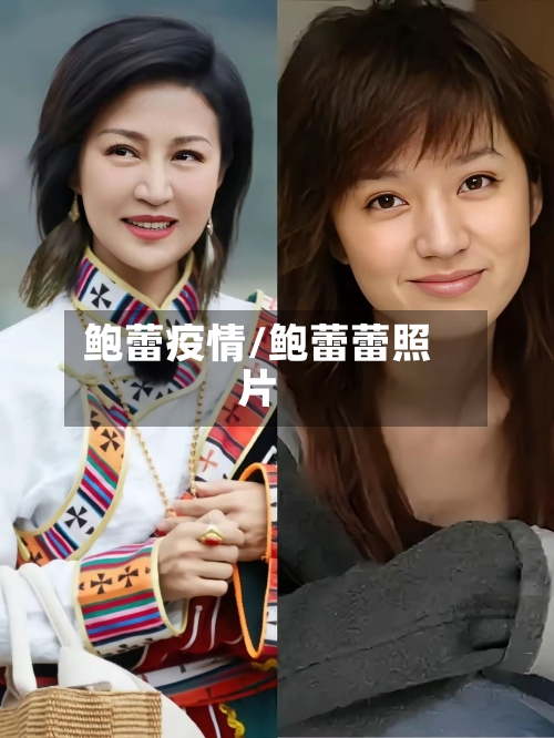 鲍蕾疫情/鲍蕾蕾照片-第3张图片